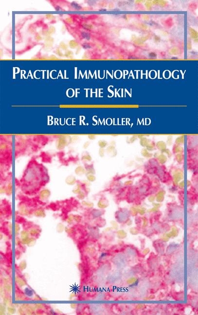Practical Immunopathology of the Skin -  Bruce R. Smoller