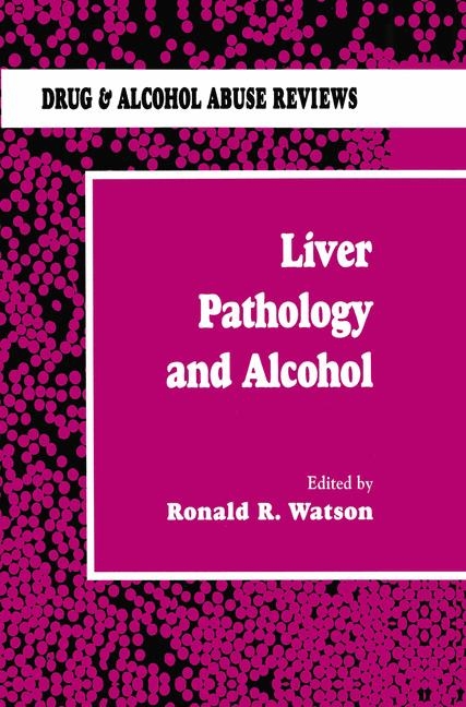 Liver Pathology and Alcohol - 