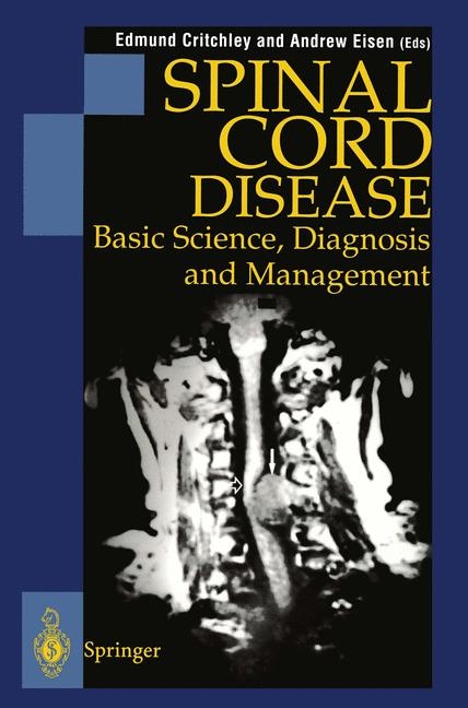 Spinal Cord Disease - 