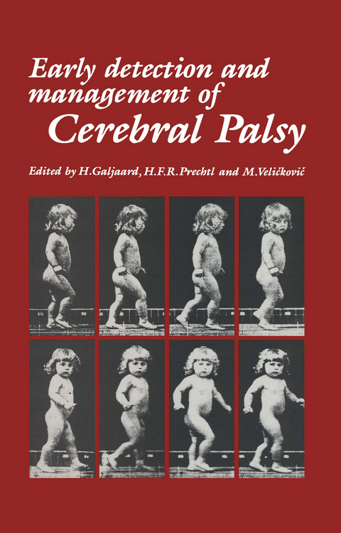 Early Detection and Management of Cerebral Palsy - 