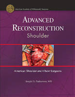 Advanced Reconstruction: Shoulder - 
