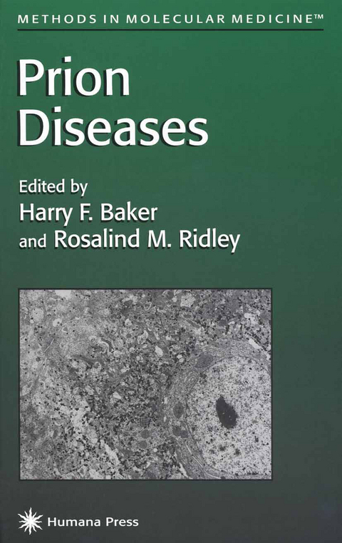 Prion Diseases - 