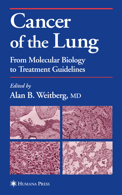 Cancer of the Lung - 