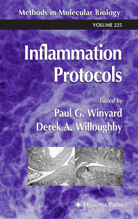 Inflammation Protocols - 