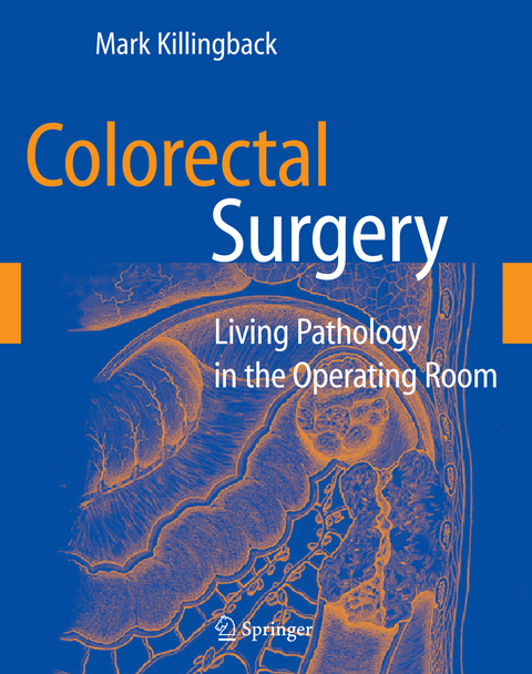 Colorectal Surgery - Mark Killingback