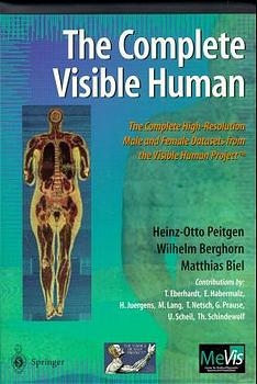 The Complete Visible Human - H.-O. Peitgen, Wilhelm Berghorn, Matthias Biel
