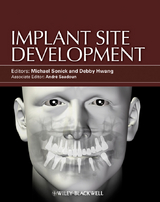 Implant Site Development - 