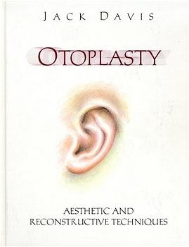 Otoplasty - J. Davis