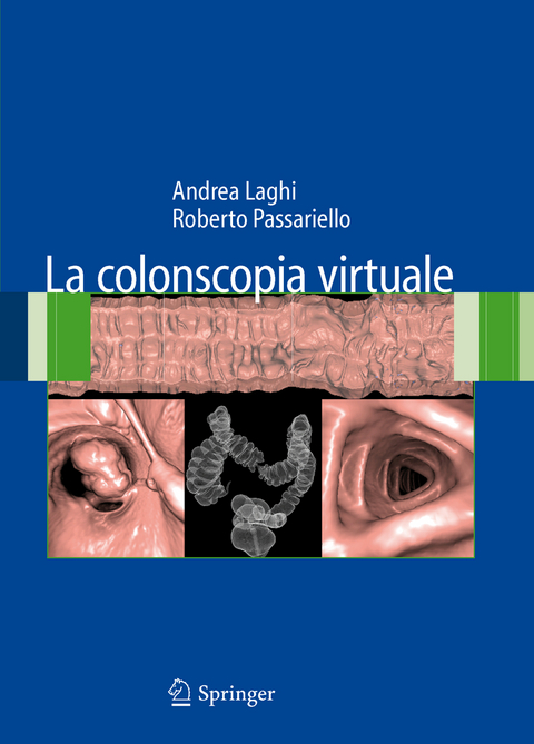 La colonscopia virtuale - Andrea Laghi, Roberto Passariello