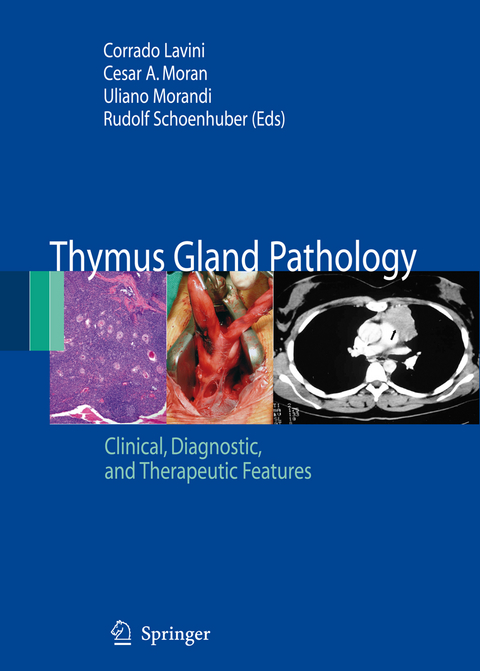 Thymus Gland Pathology - 