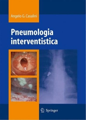 Pneumologia Interventistica - Angelo Casalini