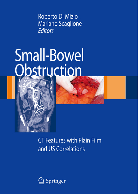 Small-Bowel Obstruction - 