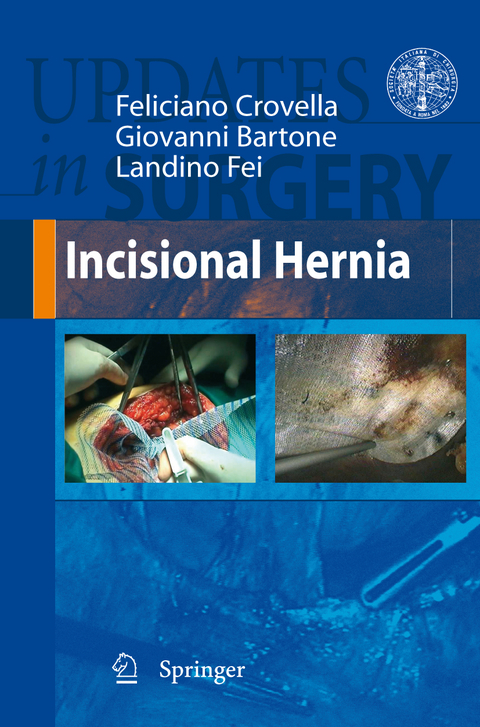 Incisional Hernia - Feliciano Crovella, Giovanni Bartone, Landino Fei