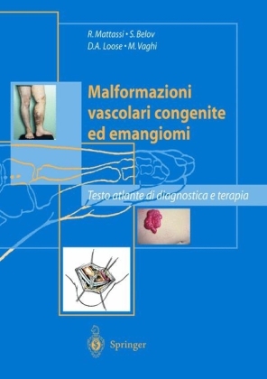 Malformazioni Vascolari Ed Emangiomi - 