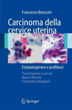 Carcinoma Della Cervice Uterina - Francesco Broccolo