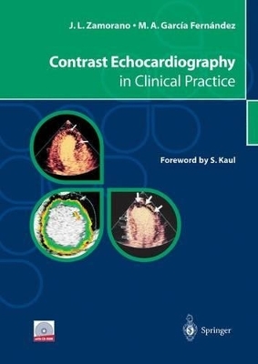 Contrast Echocardiography in Clinical Practice - J.L. Zamorano, M. A. Garcia Fernandez