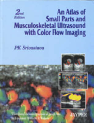 An Atlas of Small Parts and Musculoskeletal Ultrasound with Color Flow Imaging - P. K. Srivastava