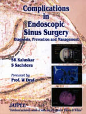 Complications in Endoscopic Sinus Surgery - Shashikant Keshavrao Kaluskar, Dr. S. Sachdeva