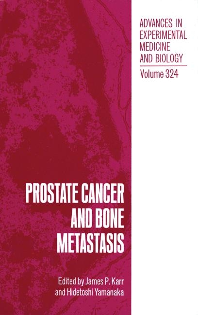 Prostate Cancer and Bone Metastasis - 