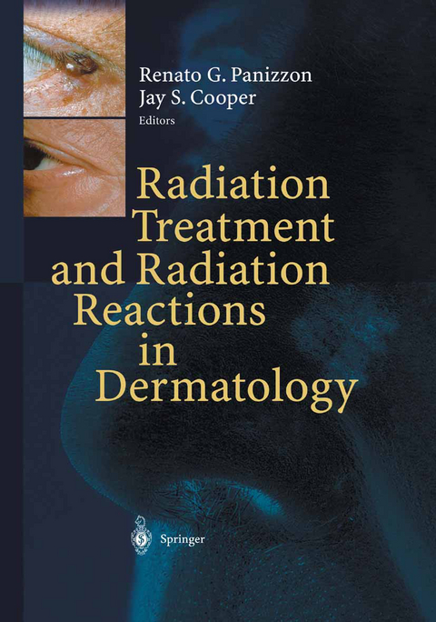 Radiation Treatment and Radiation Reactions in Dermatology - 