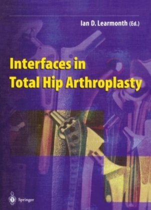 Interfaces in Total Hip Arthroplasty - 