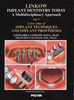 Color Atlas of Implant Techniques and Implant Prostheses - Leonard I. Linkow, Francesco Mangini