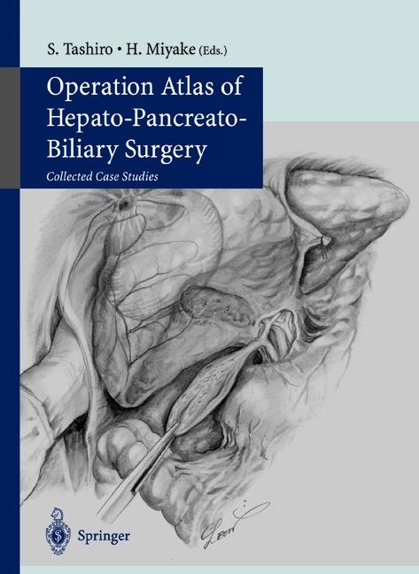 Operation Atlas of Hepato-Pancreato-Biliary Surgery - 