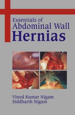 Essentials of Abdominal Wall Hernias - V. K. Nigam, S. Nigam