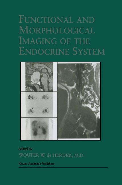 Functional and Morphological Imaging of the Endocrine System - 