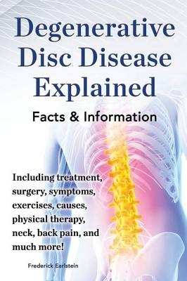 Degenerative Disc Disease Explained. Including treatment, surgery, symptoms, exercises, causes, physical therapy, neck, back, pain, and much more! Facts & Information - Frederick Earlstein