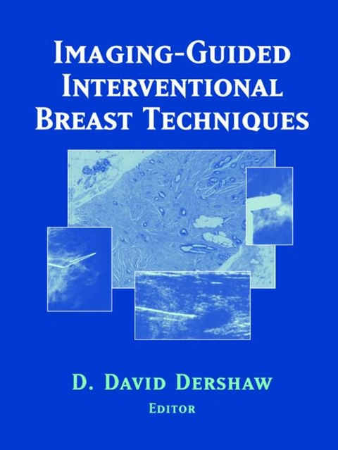 Imaging-Guided Interventional Breast Techniques - 