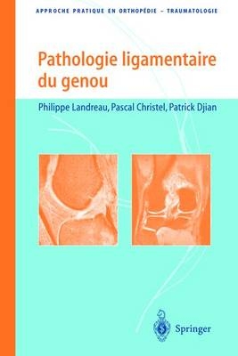 Pathologie Ligamentaire Du Genou - Philippe Landreau, Pascal Christel, Patrick Djian