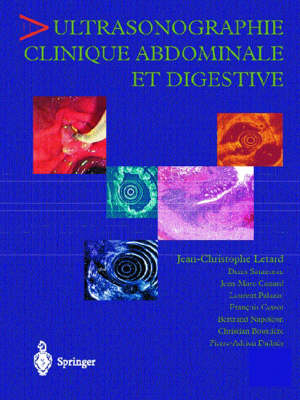 Ultrasonographie Clinique Abdominale Et Digestive - Jean-Cristophe Letard