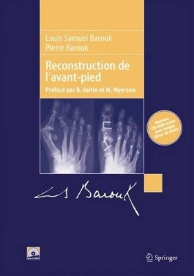 Reconstruction De L'Avant-Pied - Louis-Samuel Barouk, Pierre Barouk