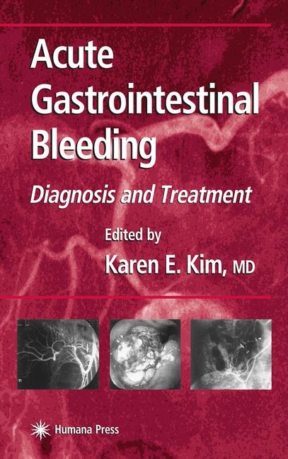 Acute Gastrointestinal Bleeding - 