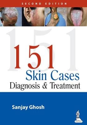 151 Skin Cases - Sanjay Ghosh