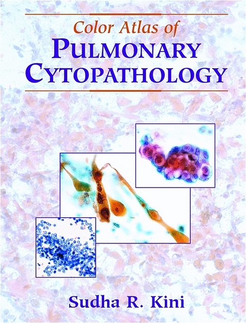 Color Atlas of Pulmonary Cytopathology -  Sudha R. Kini