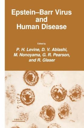 Epstein-Barr Virus and Human Disease -  D. V. Ablashi,  R. Glaser,  P. H. Levine,  M. Nonoyama,  G. R. Pearson