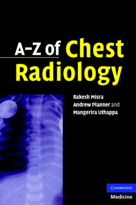 A-Z of Chest Radiology - Andrew Planner, Mangerira Uthappa, Rakesh Misra