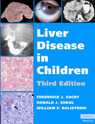 Liver Disease in Children - 