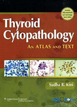 Thyroid Cytopathology - Sudha R. Kini
