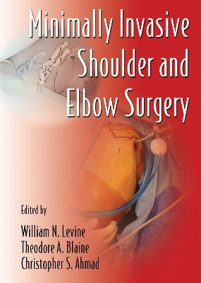 Minimally Invasive Shoulder and Elbow Surgery - 