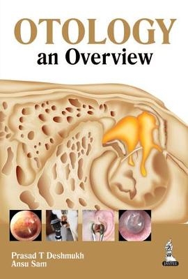 Otology: an Overview - Prasad T Deshmukh, Ansu Sam