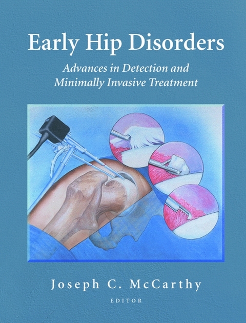Early Hip Disorders - 