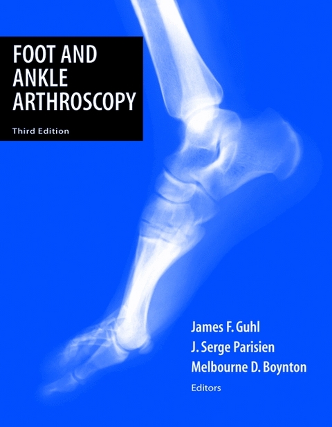 Foot and Ankle Arthroscopy - 