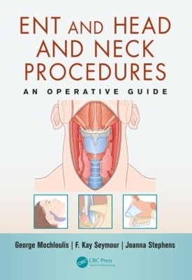 ENT and Head and Neck Procedures - George Mochloulis, F. Kay Seymour, Joanna Stephens