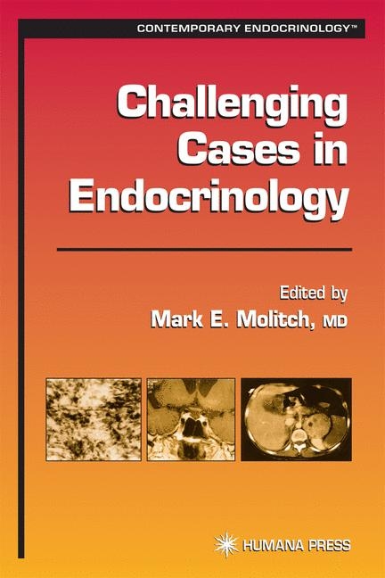 Challenging Cases in Endocrinology - 