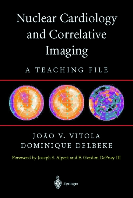 Nuclear Cardiology and Correlative Imaging - 