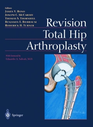 Revision Total Hip Arthroplasty - 