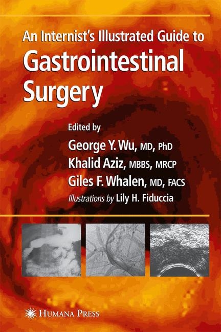 Internist's Illustrated Guide to Gastrointestinal Surgery - 